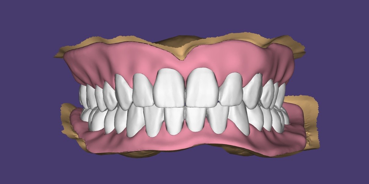 S4 Smile Ortho Services